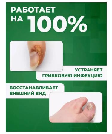 Remedy for nail fungus on the legs 2pcs cream - Buy Online on GoSupps.com