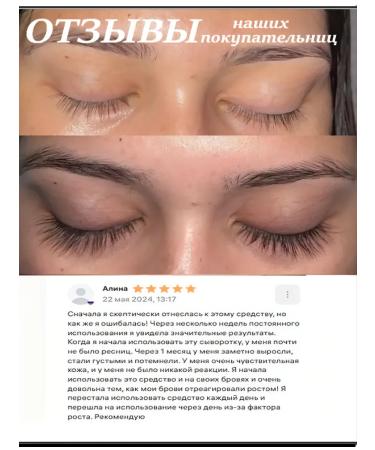 LANBENA Serum for growth and eyelash volume and eyebrows - Buy Online on GoSupps.com