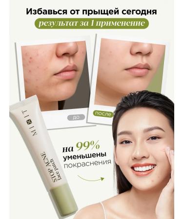 MIXIT Cream Face corrector with acids for problem skin - Buy Online on GoSupps.com