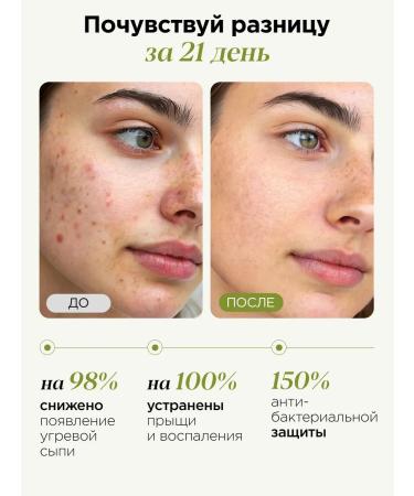 MIXIT Cream Face corrector with acids for problem skin - Buy Online on GoSupps.com