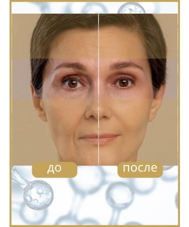 BELITA Meso skin cream around the eyes Complex rejuvenation 50+ - Buy Online on GoSupps.com
