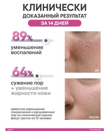 Lefami Cream serum for narrowing pores from acne - Buy Online on GoSupps.com