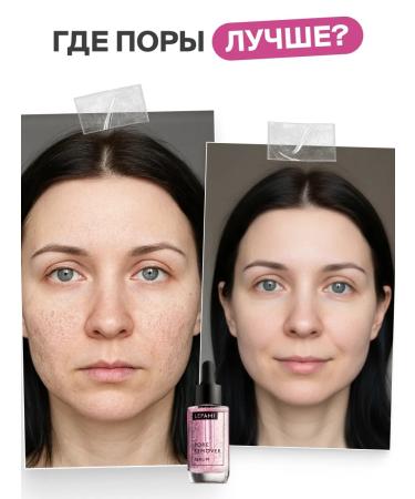 Lefami Cream serum for narrowing pores from acne - Buy Online on GoSupps.com
