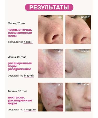 Lefami Cream serum for narrowing pores from acne - Buy Online on GoSupps.com