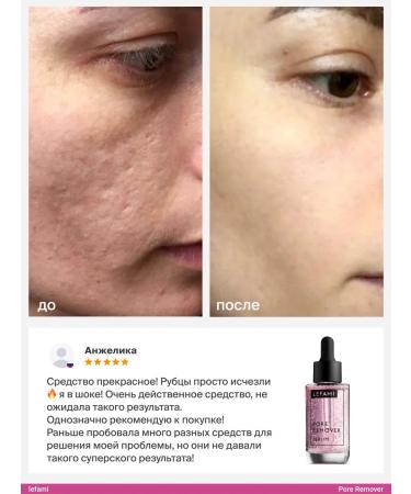 Lefami Cream serum for narrowing pores from acne - Buy Online on GoSupps.com