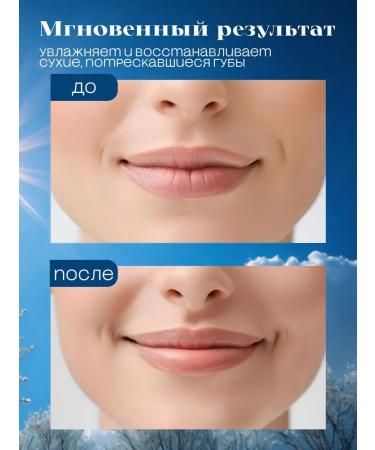 Blistex Healing lip balm 4.25 grams - Buy Online on GoSupps.com