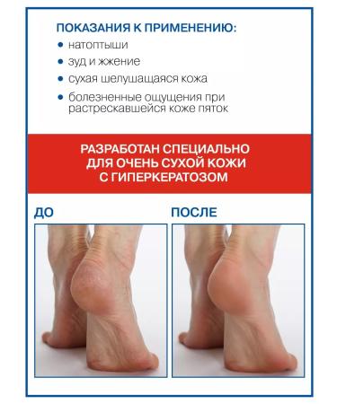 NANO-HEELS Leg cream with urea - Buy Online on GoSupps.com