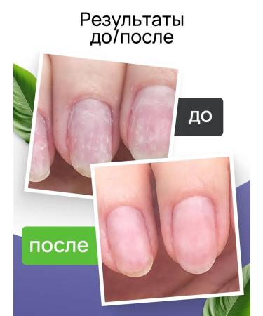 Lokopro Regenerating gel for nails - Buy Online on GoSupps.com