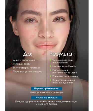 LAB Facial serum from acne and acne - Buy Online on GoSupps.com