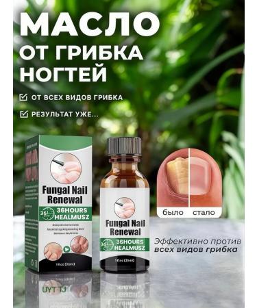 varnish from nail fungus on the legs treatment 30 ml