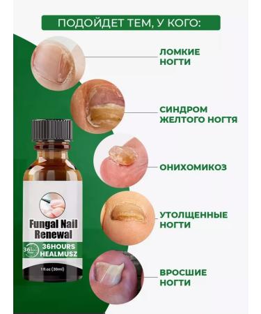 varnish from nail fungus on the legs treatment 30 ml - Buy Online on GoSupps.com