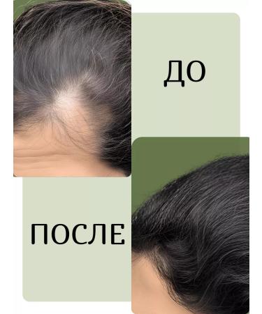 Sofid Oil for hair growth and eyebrows restoring - Buy Online on GoSupps.com
