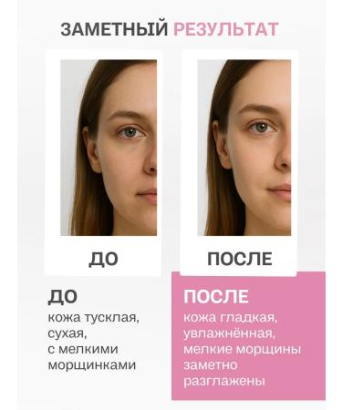 Sofid Face lifting from wrinkles and pigmentation massage - Buy Online on GoSupps.com