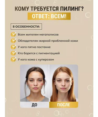 Almond face peeling acidic with arbutin - Buy Online on GoSupps.com