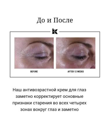 KIEHL'S Super Multi-Corrective Eye Zone Treatment Eye Cream - Buy Online on GoSupps.com