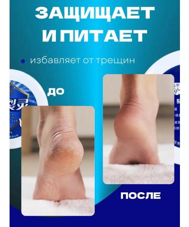 Healing cream Chinese magician - Buy Online on GoSupps.com