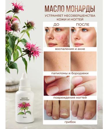 BioHerb Rosemary oil for growth and hair strengthening 30 ml - Buy Online on GoSupps.com