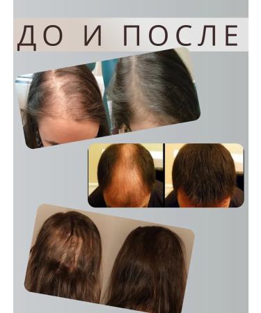 LOSTAY Oil from hair loss with rosemary extract - Buy Online on GoSupps.com
