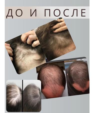 LOSTAY Oil from hair loss with rosemary extract - Buy Online on GoSupps.com