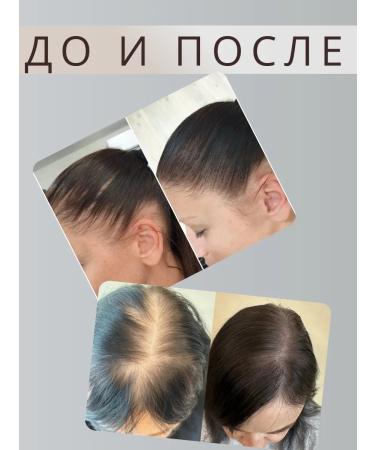 LOSTAY Oil from hair loss with rosemary extract - Buy Online on GoSupps.com