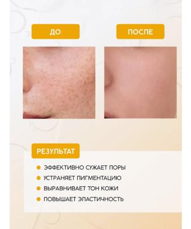 Bielenda Overpigmentation Acidy Night Cream STEP STEP 1 - Buy Online on GoSupps.com