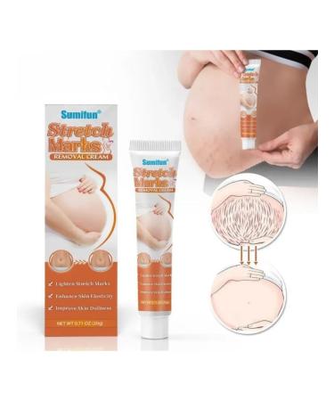 NazPalad Cream from stretch marks and scars for pregnant women moisturizing - Buy Online on GoSupps.com