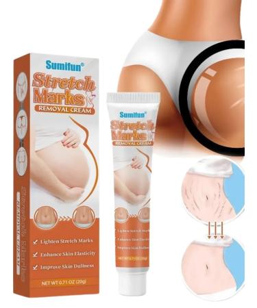 NazDiamo Cream from stretch marks and scars for pregnant women moisturizing - Buy Online on GoSupps.com