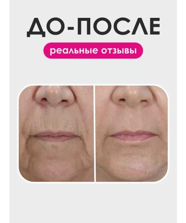 KeepBeauty Rejuvenating face cream with niacinamide - Buy Online on GoSupps.com
