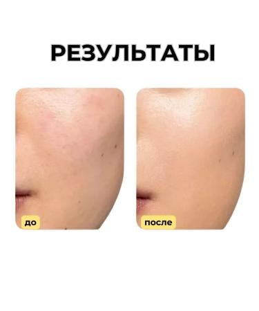 MEDI PEEL ORIGINAL KOREAN Golden Camelia premium face cream from wrinkles 50 g - Buy Online on GoSupps.com