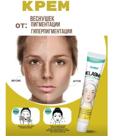 Janar brands Whitening against pigmentation cream serum