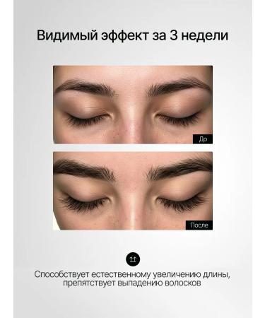 miolove Oil for the growth of eyelashes and eyebrows with the content of uzma - Buy Online on GoSupps.com