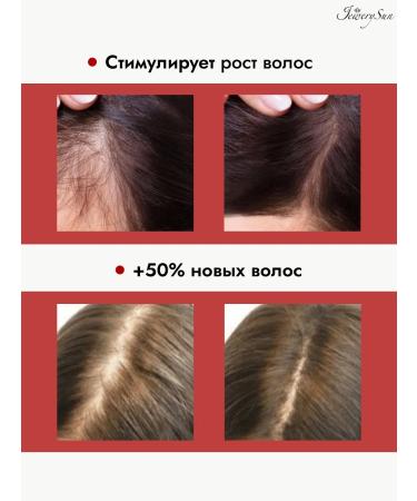 Jewery Sun Hair growth and from red pepper - Buy Online on GoSupps.com