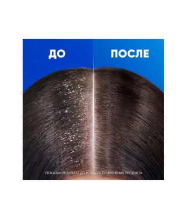 Kerasys greasy hair dandruff - Buy Online on GoSupps.com