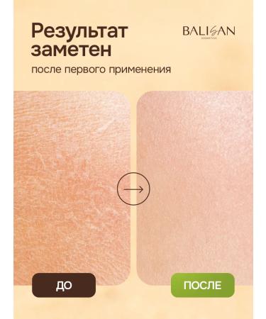 Balisan hand and body cream with urea 500 ml - Buy Online on GoSupps.com