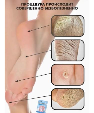 sadoer Moisturizing foot mask Nutrient socks Piling - Buy Online on GoSupps.com