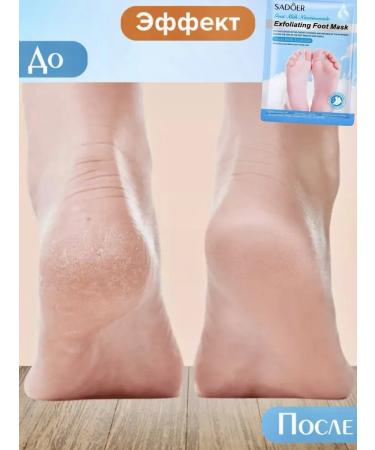 sadoer Moisturizing foot mask Nutrient socks Piling - Buy Online on GoSupps.com