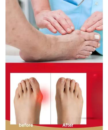 KazBrand Ointment from rheumatism of valgus deformation of the foot - Buy Online on GoSupps.com