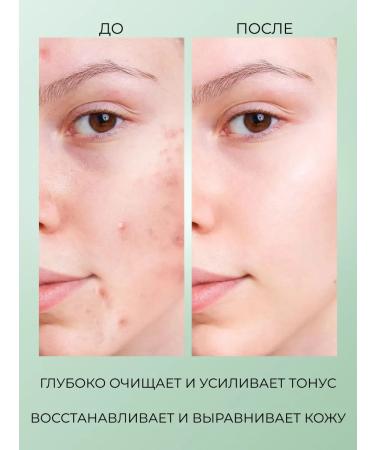 Million Pauline Facial Piling - Buy Online on GoSupps.com