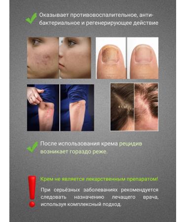 Hamar Thai ointment from psoriasis 29a - Buy Online on GoSupps.com