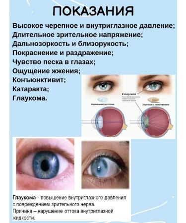 Vyas Udala vitamins for the eyes 300 tab - Buy Online on GoSupps.com