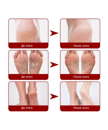 Exfoliating legs mask with fruit acids - Buy Online on GoSupps.com