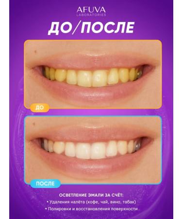 AFUVA Toothpaste whitening from caries and plaque - Buy Online on GoSupps.com