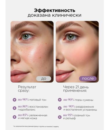 MIXIT Facial serum from acne matting cream tonic - Buy Online on GoSupps.com