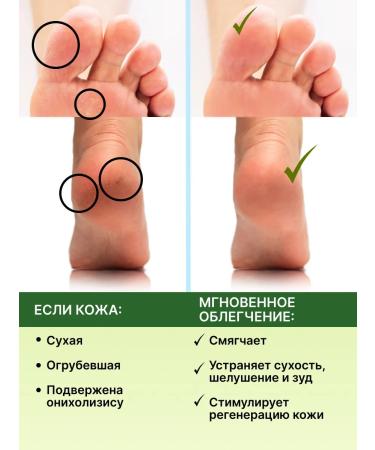 MustMaster Multipasta for nails and skin from fungus and onicholysis - Buy Online on GoSupps.com