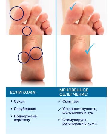 MustMaster Balm from cracks on the heels healing - Buy Online on GoSupps.com