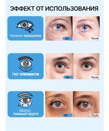 MANUWKA Eye patches from edema and dark circles - Buy Online on GoSupps.com