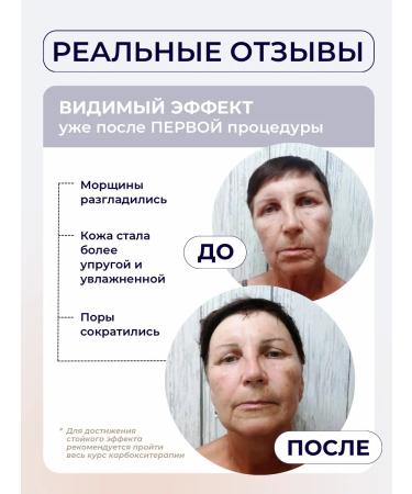 The Mag cosmetics Facial masks fabric set of carboxytherapy - Buy Online on GoSupps.com