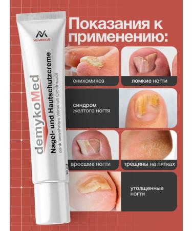 DemykoMed Cream from nail fungus and cracks - Buy Online on GoSupps.com