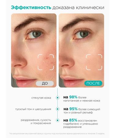 MIXIT Moisturizing face and face cream for dry skin Lab - Buy Online on GoSupps.com