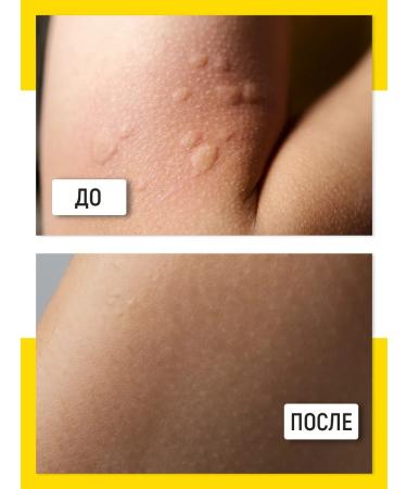 Walnut Gel balm after bite of insects and burns - Buy Online on GoSupps.com